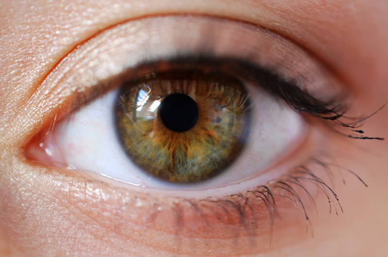 Hazel eye