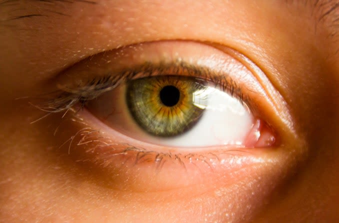 Hazel eye