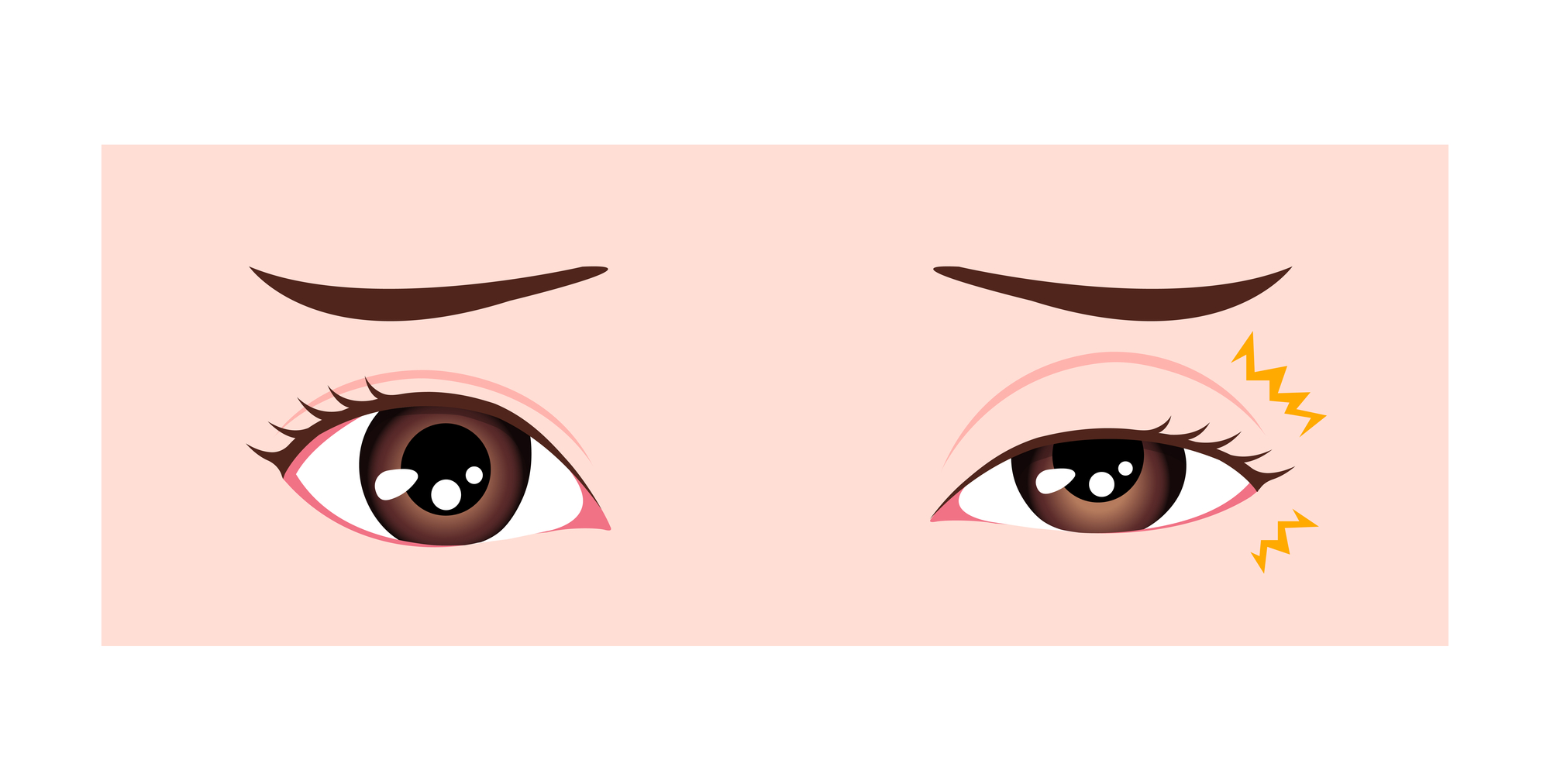 Illustration of an eye twitching