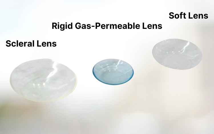 Scleral vs rgp vs soft contact lenses vc edited