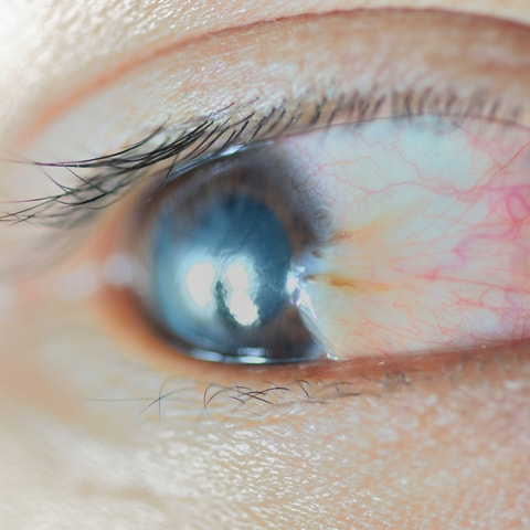 Close-up of a human eye looking to the side. The image shows detailed textures of the iris, sclera, and surrounding skin, including visible blood vessels. Light reflections can be seen on the surface of the eye.