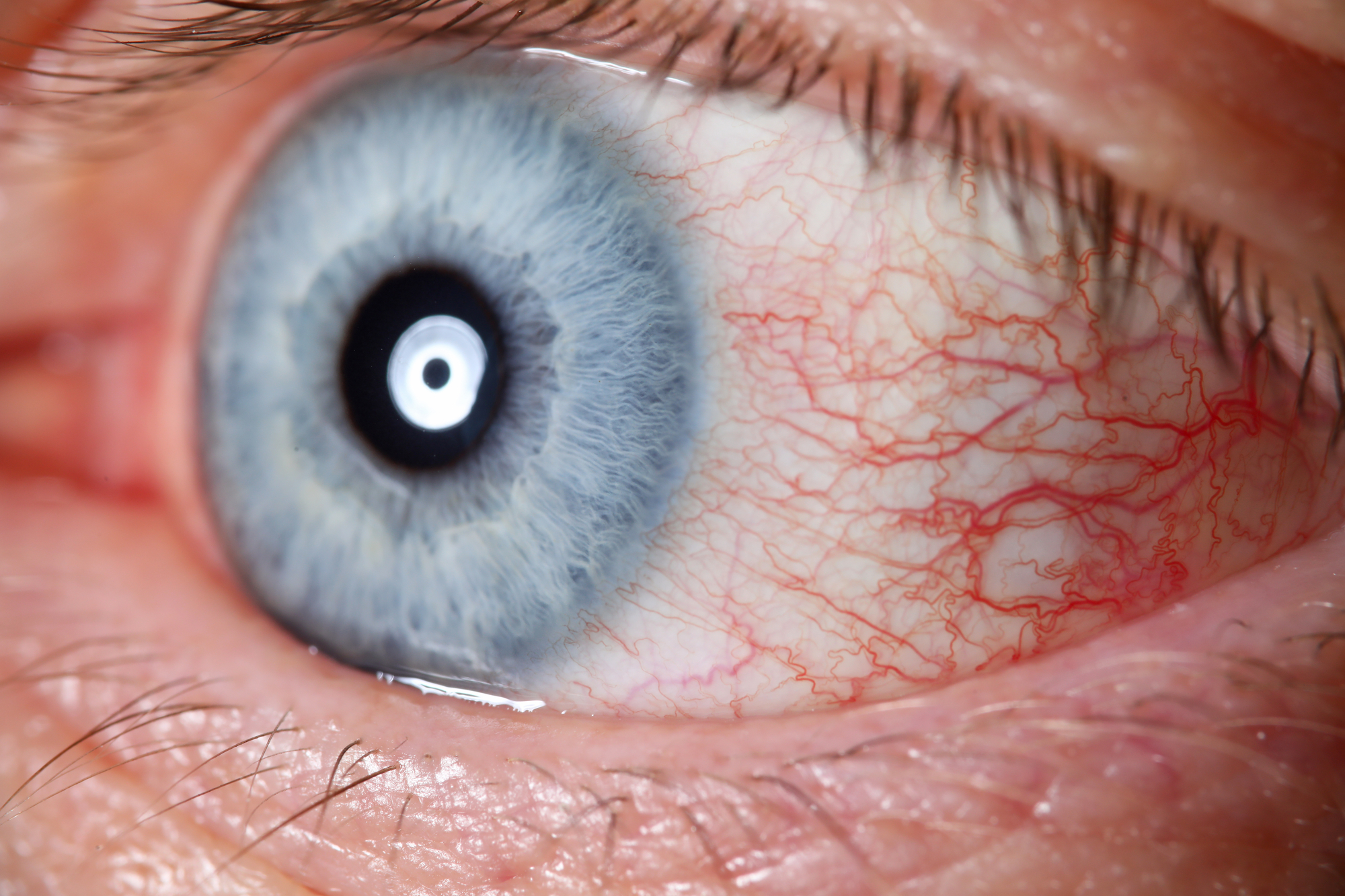 Close-up image of a human eye with a blue iris, visible red blood vessels on the sclera, and detailed textures of the eyelid and eyelashes. The eye is open wide, highlighting the intricate patterns in the iris and the blood vessels.
