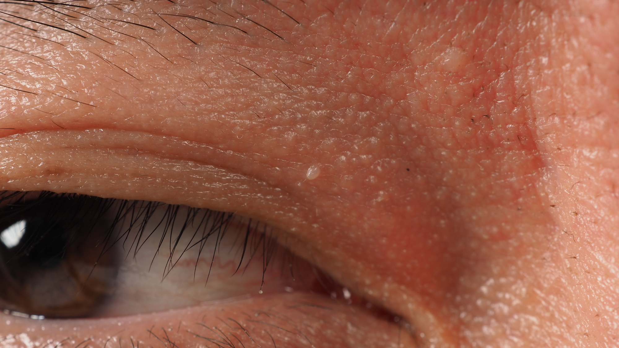 Close-up image of the skin around a person's eye, showing fine lines, pores, and wrinkles. The texture is detailed, and some small bumps or blemishes are visible. Eyelashes and part of the eyebrow can be seen at the edge.