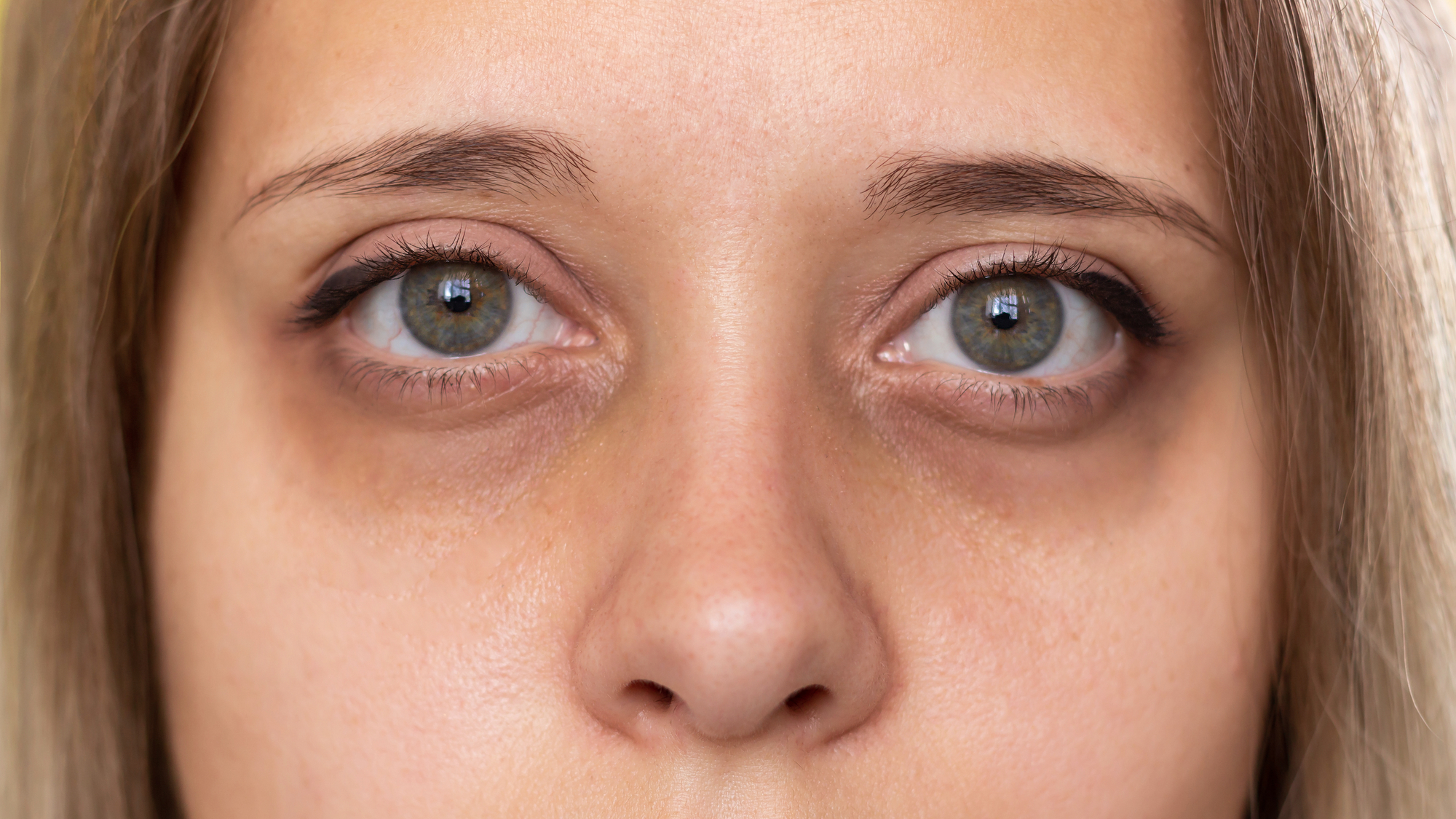 Cropped shot of dark circles under the green eyes of a young woman
