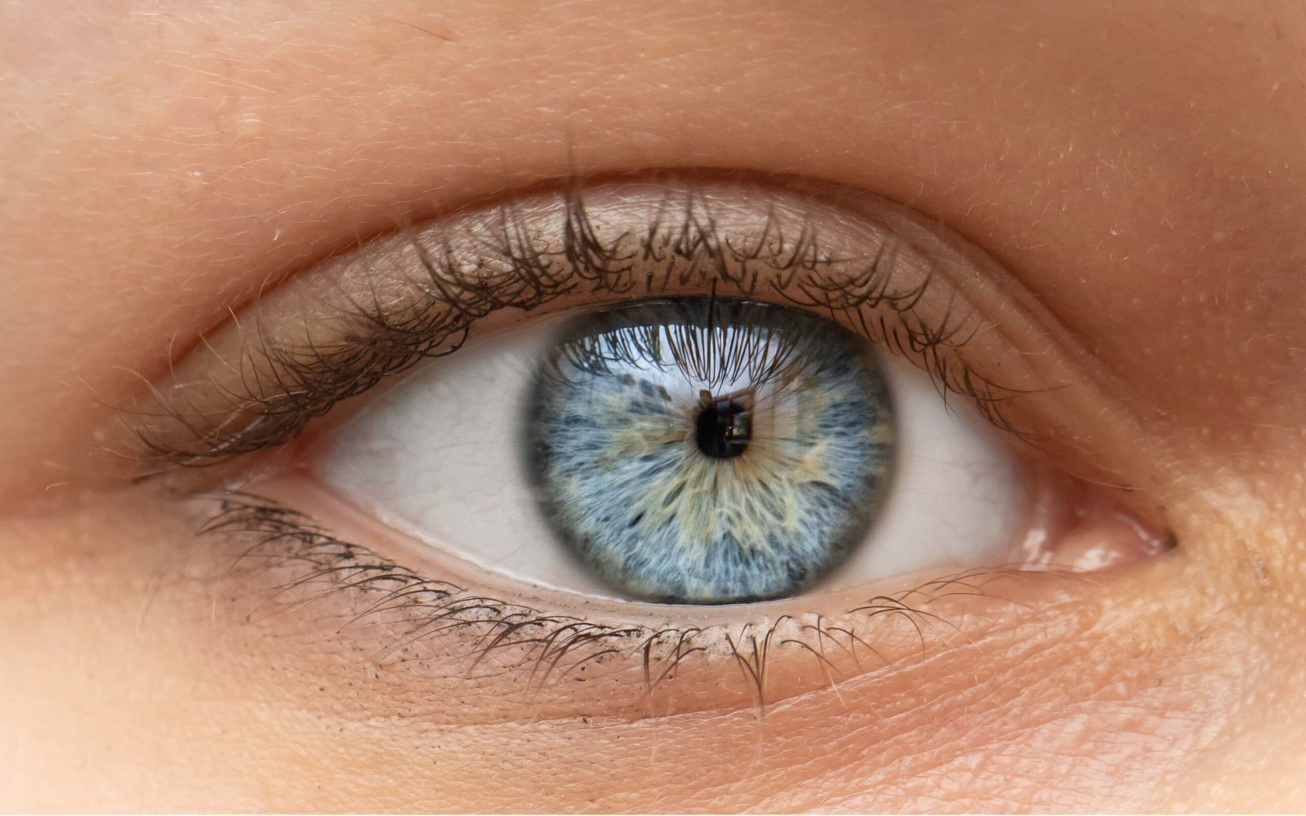 Close up shot of womna s eyes with miosis edited scaled